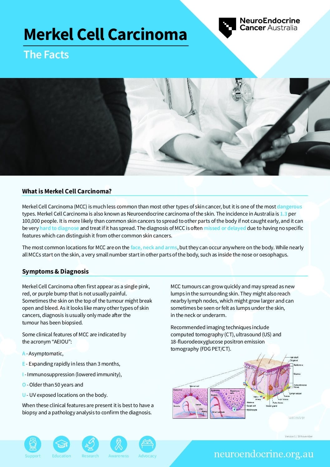 Merkel Cell Ca Fact Sheet 2023