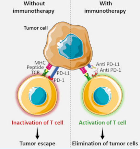 Merkel Cell Carcinoma 2 image3